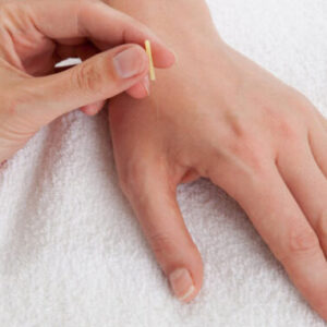 Formación en Acupuntura Coreana <span>de Mano</span>
